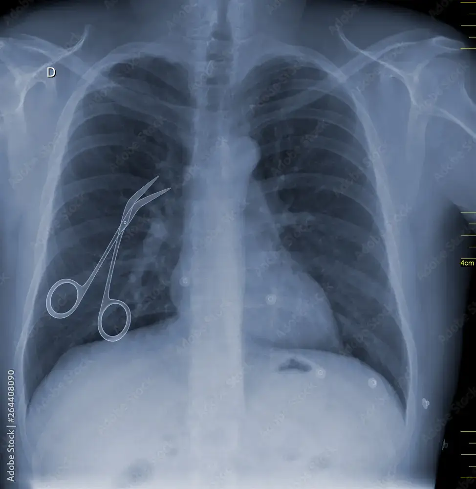 Find a Medical Malpractice Lawyer at the Coker Accident Lawyers